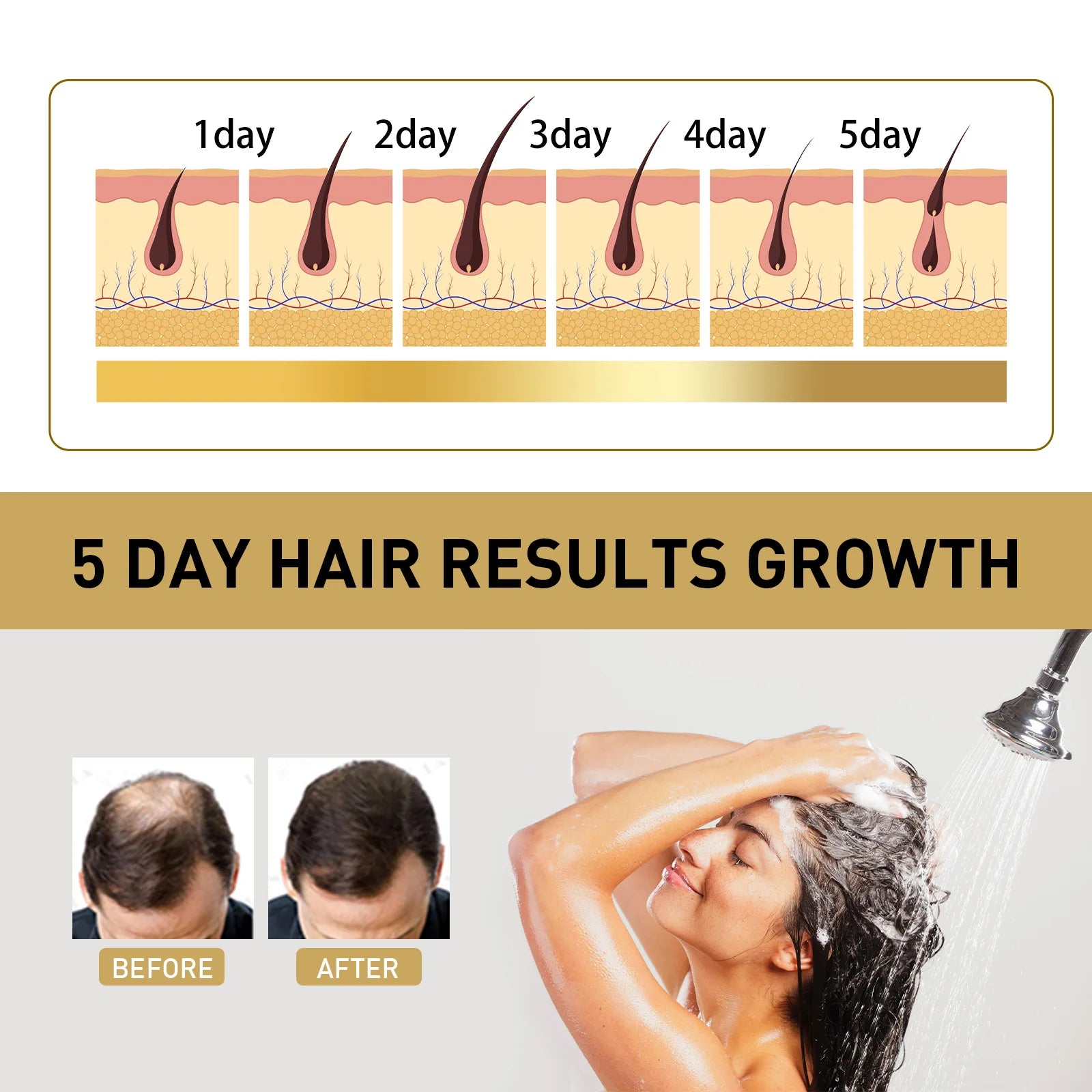 Ginger Regrowth Shampoo anti Hair Loss Oil Control Dandruff Removal Moisturiz Nourish Scalp Repair Damaged Hair Growth Shampoo